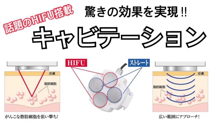 脂肪を溶かす？！キャビテーション とは…高松市でダイエットしたい方必見！｜ありす鍼灸整骨院（ありす整体院）高松市の骨盤痩身&総合健康美容サポート｜香川県高松市十川東町８３−１